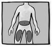 Methotrexaat (MTX) injecties