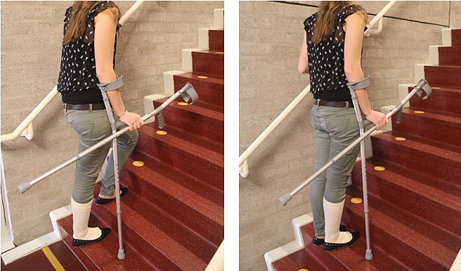 Foto. Op de foto: een vrouw die een trap oploopt met krukken